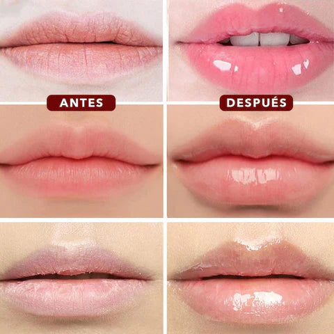 VOLUMINIZADOR DE LABIOS
